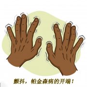 顫抖，帕金森病的開端 帕金森的癥狀有哪些